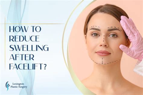 How To Reduce Swelling After Facelift Effective Tips And Tricks