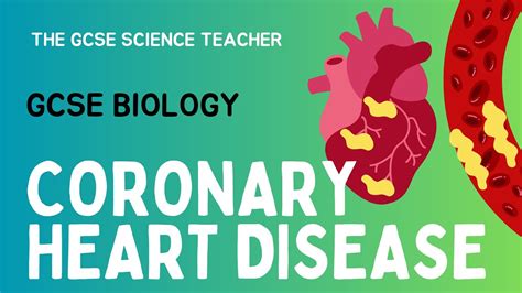 GCSE Biology Coronary Heart Disease The GCSE Science Teacher AQA