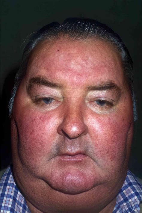 moon shaped face   infoupdateorg