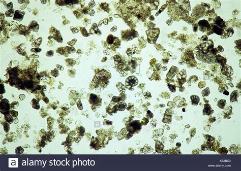 Foraminifera Under Microscope