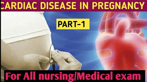 Cardiac Disease In Pregnancy Ii Problem During Pregnancy Ii Part 1 Ii