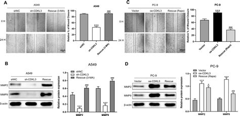 CDKL3 Might Promote NSCLC Metastasis By Inhibiting Autophagy A B