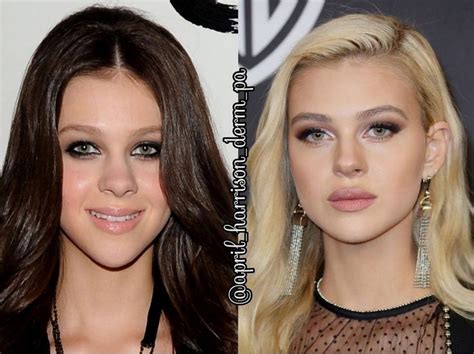 Nicola Peltz Nose Job Before And After