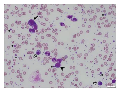 Giemsa Stain Preparation Procedure Principle Off