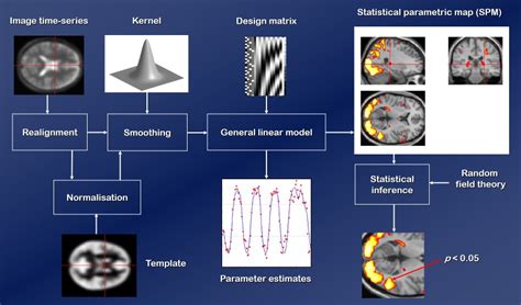 SPM Statistical Parametric Mapping