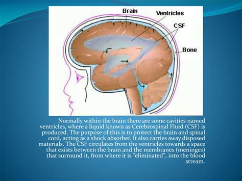 Ppt Cerebral Circulation And Csf Formation Powerpoint Presentation Id