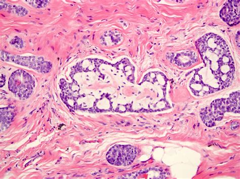 Pathology Outlines Who Classification