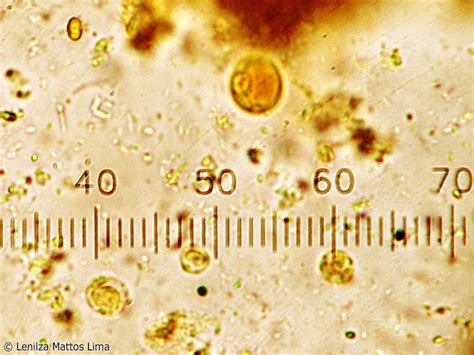 Cistos De Entamoeba Histolytica E Dispar Fotografias Microscópicas E Macroscópicas Atlas