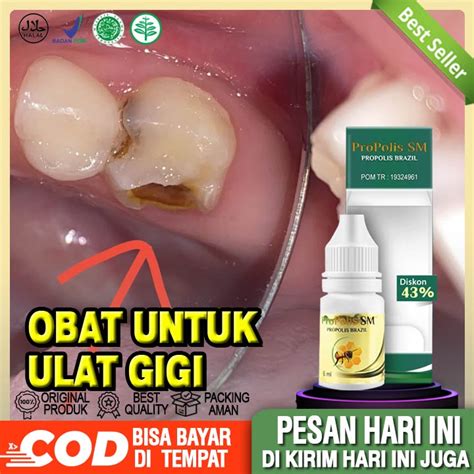 Jual Obat Ulat Gigi Obat Penghilang Ulat Gigi Obat Sakit Gigi Keluar