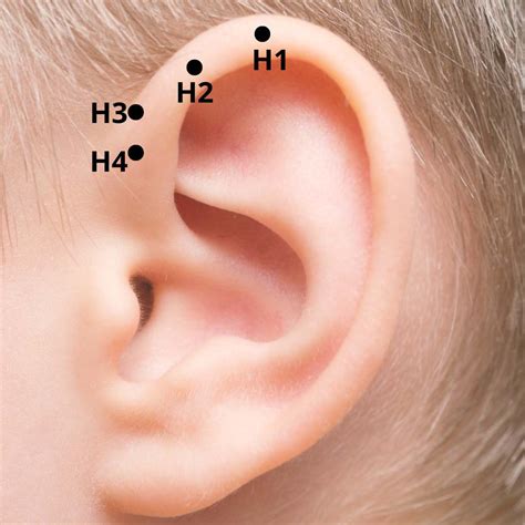 Regi Es Da Orelha E A Acupuntura Wiki Acupuntura