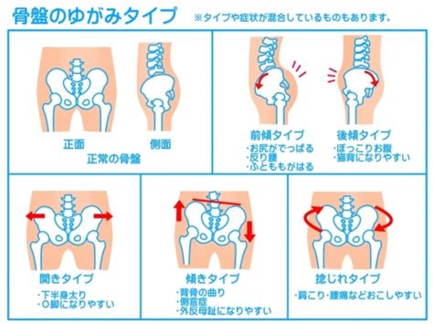 骨盤の役割とは・・・？ 福岡市、早良区にあるジム「アイズトータルボディステーション 西新店」