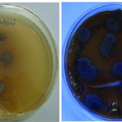 Trichophyton interdigitale. | Download Scientific Diagram