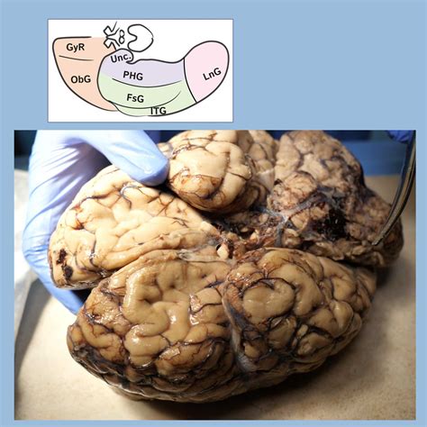 Neuroanatomy Glossary: Gyrus Rectus | ditki medical & biological sciences