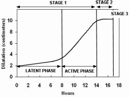 Prodromal Labor To Active Labor Stage