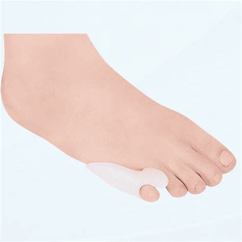 Bunionette Corrector Tailors Bunion Pad 6 Pcs Gel Little Toe Bunion