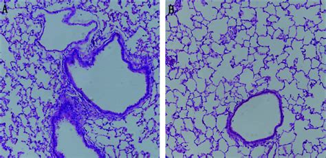 Macroscopic images (200× magnification) of lung tissue (HE staining ...