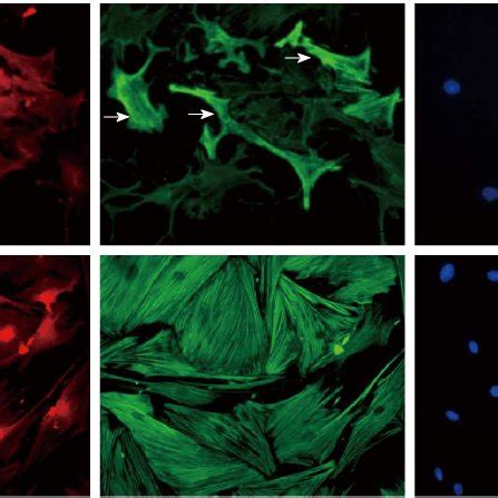 Morphological features and α SMA expression of cultured hepatic