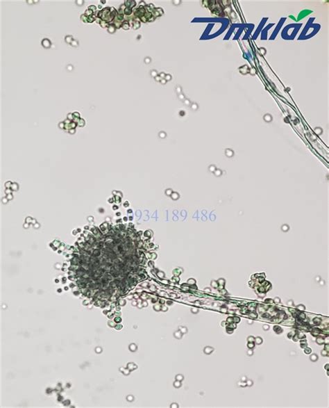 Ti U B N N M Aspergillus Flavus Dmk Lab