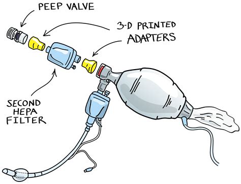 Bag Mask Ventilation With Hepa Filter