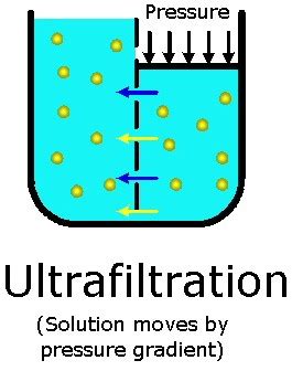 How Hemodialysis Works: Dialysis Machine, Medical, Extracorporeal, Diffusion, Ultrafiltration ...