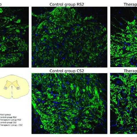 Immunofluorescence Staining Of The Ventral Horns Of The Spinal Cords In