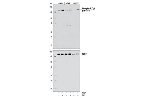 Phospho VEGF Receptor 2 Tyr1175 19A10 Rabbit MAb Cell Signaling