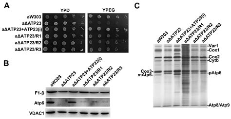 IJMS Free Full Text T1121G Point Mutation In The Mitochondrial Gene