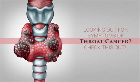 Looking out for symptoms of Throat Cancer? Check this out! - Cancer ...