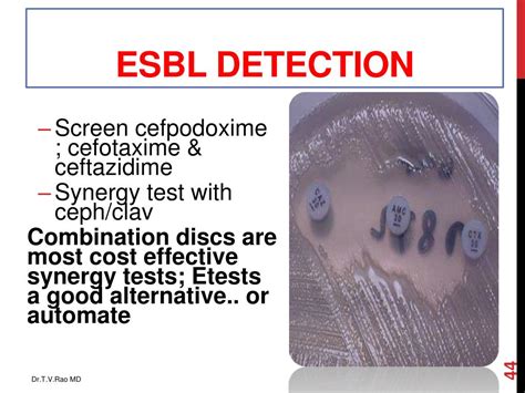 Ppt Esbl Dynamics And Detection Powerpoint Presentation Id