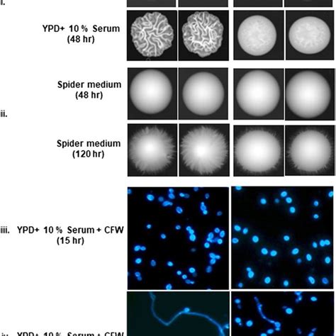 Candida Albicans Rad30Δ Cells Display Differential Morphogenesis With