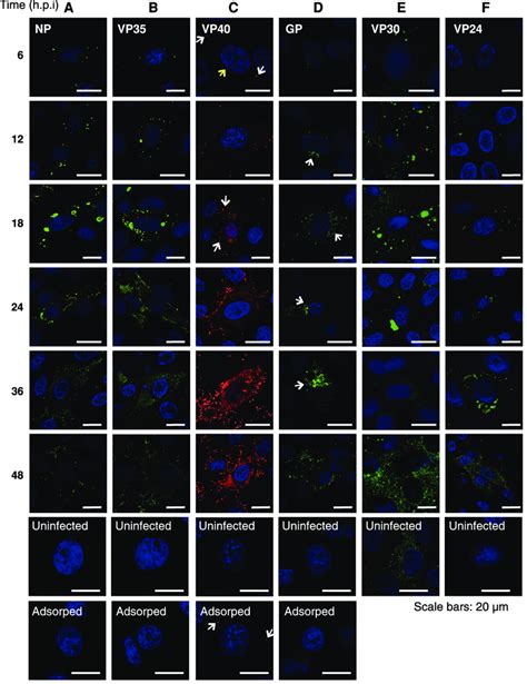 Spatio Temporal Distribution Dynamics Of EBOV Proteins In