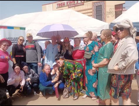 Persons With Albinism Cry Out Against Alleged Stigmatisation In Akwa