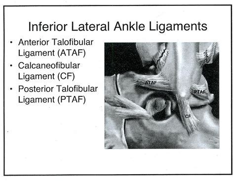 Radiology Cases: Lateral and Medial Ankle Ligaments