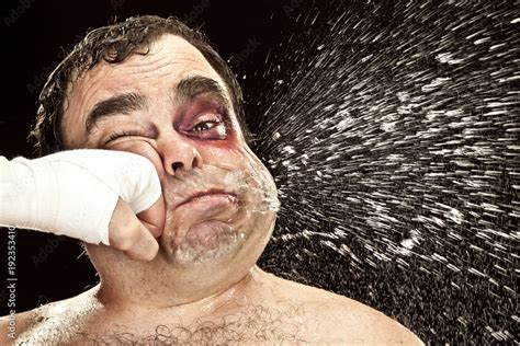 Black Eye Wound Boxer Spit Due Big Punch Hit Portrait Stock Photo