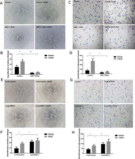 Neuropilin 1 Aggravates Liver Cirrhosis By Promoting Angiogenesis Via