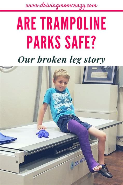 Are Trampoline Parks Safe Our Broken Leg Story Driving Mom Crazy