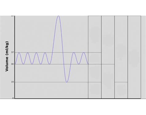 Ventilation Graph Quiz