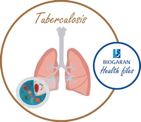 Understanding Tuberculosis Biogaran Africa