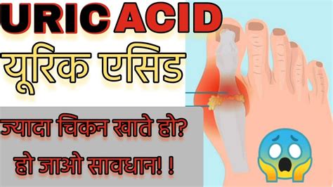 What Is Uric Acid यूरिक एसिड क्या हैंचिकन से यूरिक एसिड बढ़ता हैं