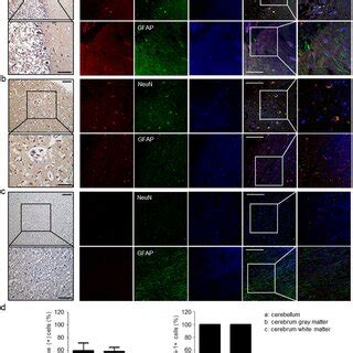 Expression Of AEG 1 In The Cerebellum And Cerebrum Of The Normal Human