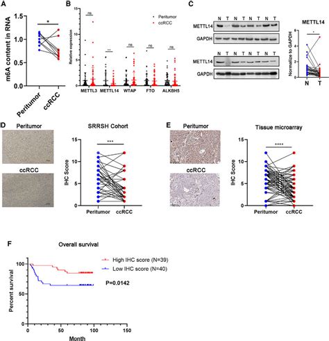 Decreased METTL14 Expression Correlates To Poor Prognosis In CcRCC