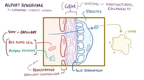 Alport Syndrome Video Anatomy Definition Function Osmosis