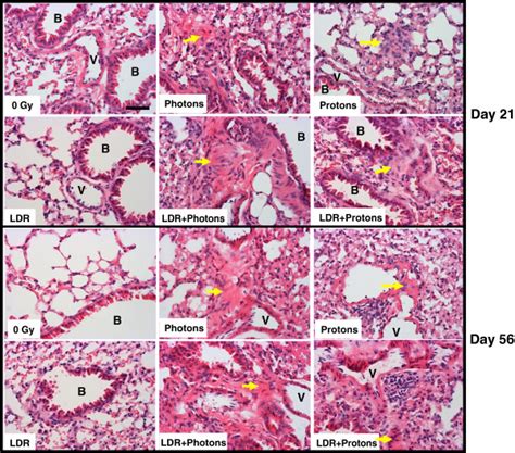 Photomicrographs Of Representative Histopathological Profiles Sections