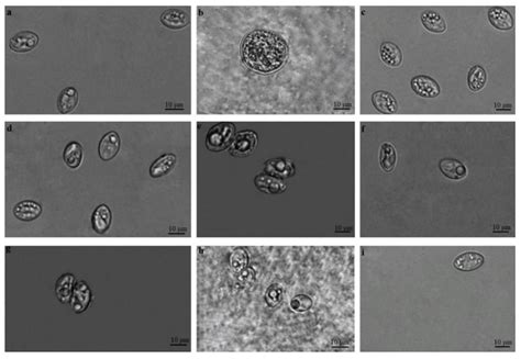 Sarcocystis Parasites