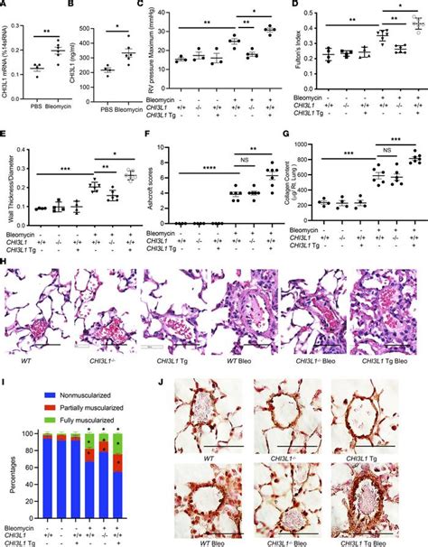 Jci Insight Chitinase Like Contributes To The Development Of