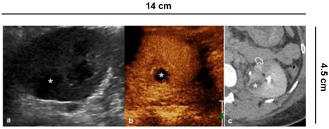 Diagnostics Free Full Text Role Of Contrast Enhanced Ultrasound