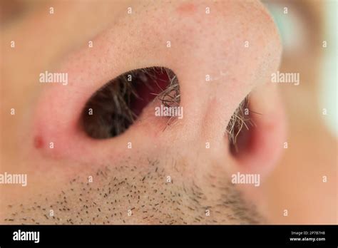 Caucasian Male Unkempt Nose Hair Follicles Macro Close Up Shot Close Up Shot Unrecognizable