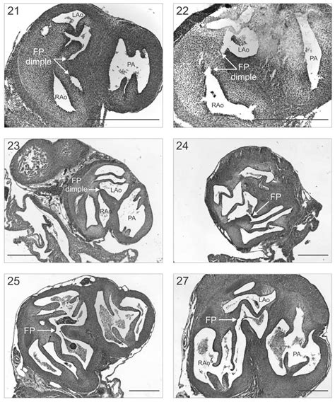 Transverse Sections Through The Developing Heart Of Alligator