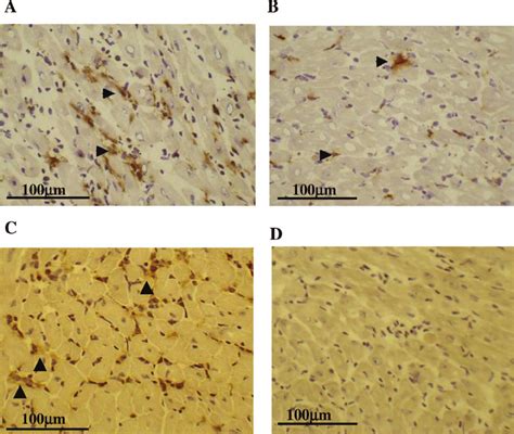 Demonstration Of Endothelial Cell Activation And Microvascular Damage