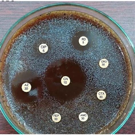 Susceptibility test using Kirby–Bauer disk diffusion method. | Download Scientific Diagram